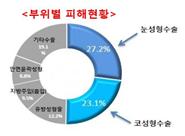 성형수술 부위별 피해현황