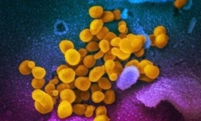코로나19 바이러스 전자현미경 영상 (미국 국립 알레르기 감염병 연구소 제공)