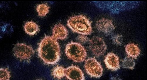 코로나19를 일으키는 신종 코로나바이러스의 전자현미경 사진.
