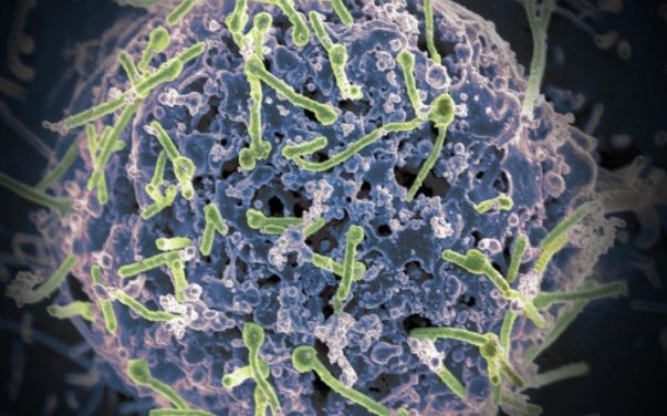 에볼라 바이러스 전자현미경 이미지