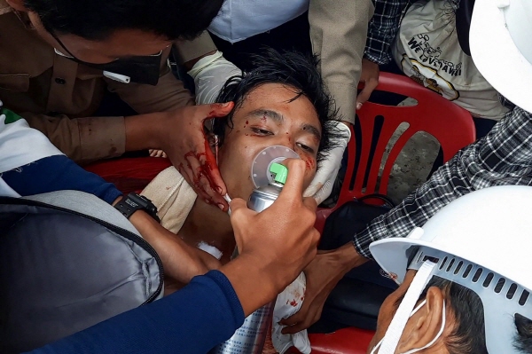 미얀마 남부도시 다웨이에서 28일 열린 반쿠데타 시위에 참가했다가 다쳐서 의료진의 치료를 받고 있는 시민